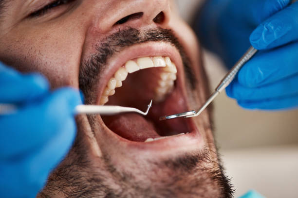 Best Dental Abscess Treatment in Coosada, AL